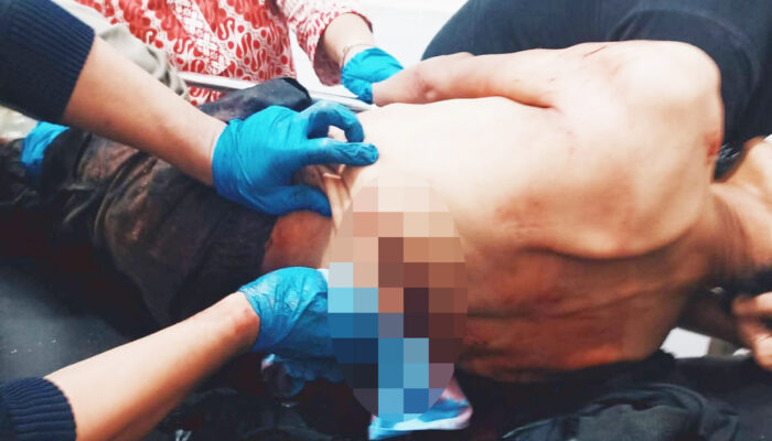Gerombolan Gemot Secara Brutal Bacokin Warga Hingga Kritis Punggung Terbelah