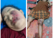 Ibu dan Anak Kritis Usai Dibegal di Medan Deli