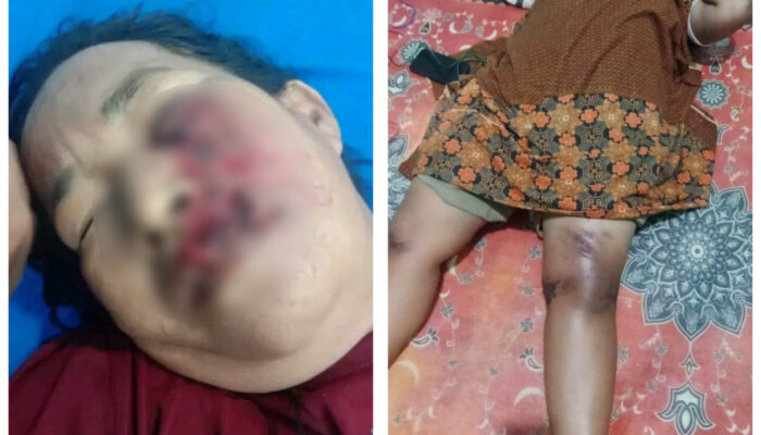 Ibu dan Anak Kritis Usai Dibegal di Medan Deli