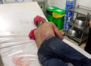 Penganiayaan Brutal Terhadap Security Oleh Sekelompok OTK, Polsek Medan Labuhan Buru Para Pelaku