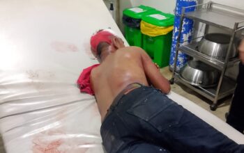 Penganiayaan Brutal Terhadap Security Oleh Sekelompok OTK, Polsek Medan Labuhan Buru Para Pelaku
